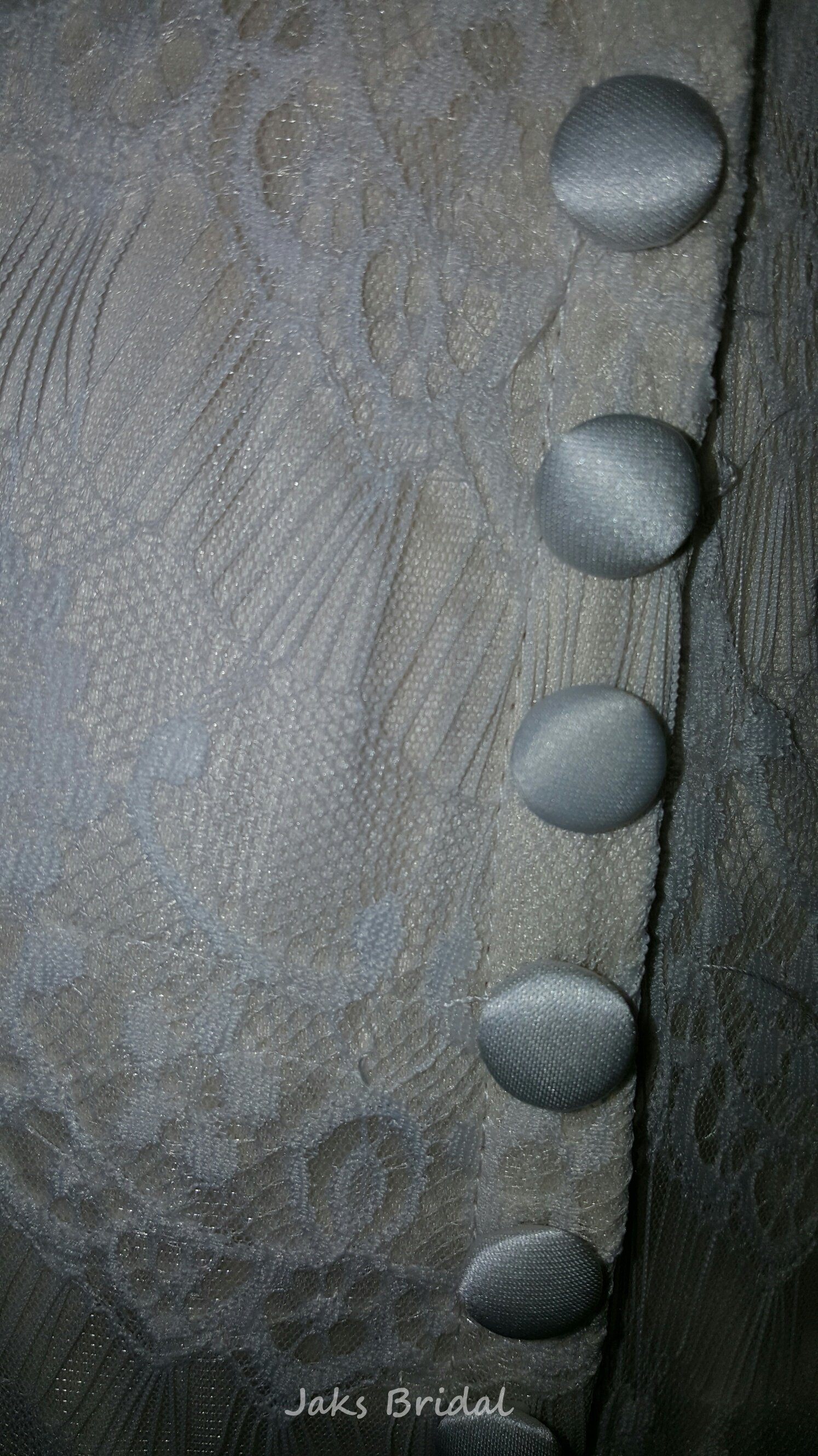 covered buttons over zipper